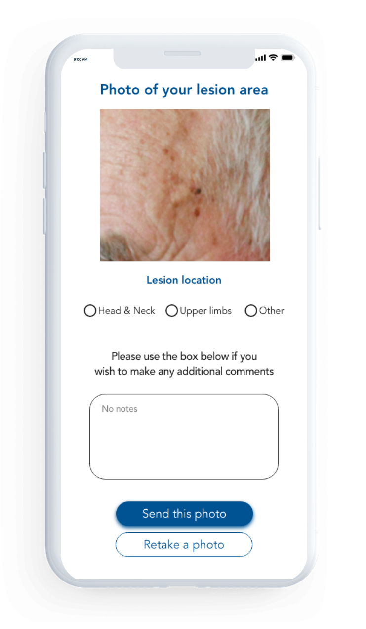 SmartPDT in-app patient gallery
